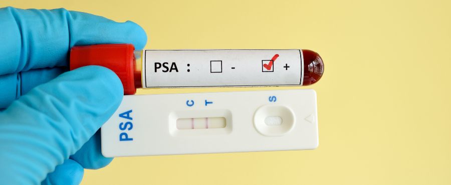 tubo com sangue para fazer o exame PSA